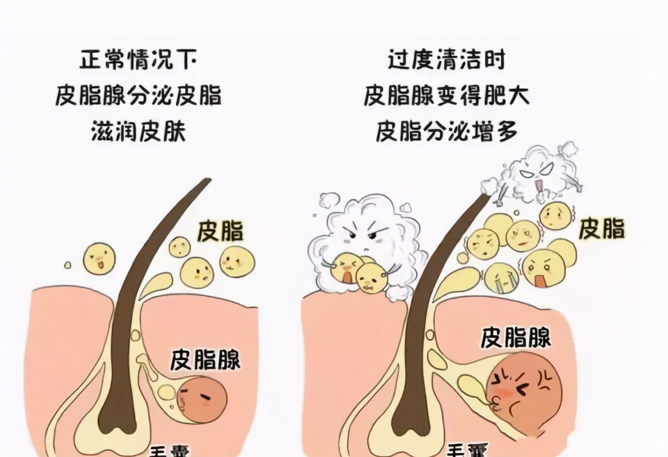 清洁面膜哪个牌子效果比较好贴吧（清洁面膜哪个牌子效果比较好）(图3)
