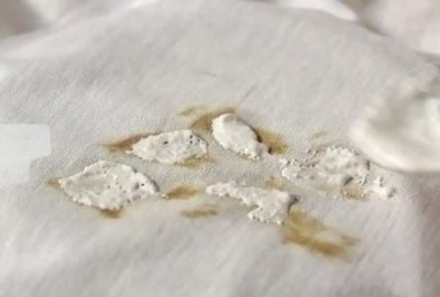 ​白裤子上的黄斑怎样能洗掉,白色裤子上面有黄色 的污渍怎么去除掉