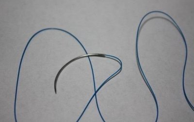 ​埋线疗法 穴位埋线疗法