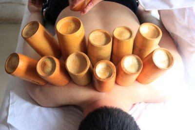​拔火罐的好处与功效（拔火罐的正确操作方法）