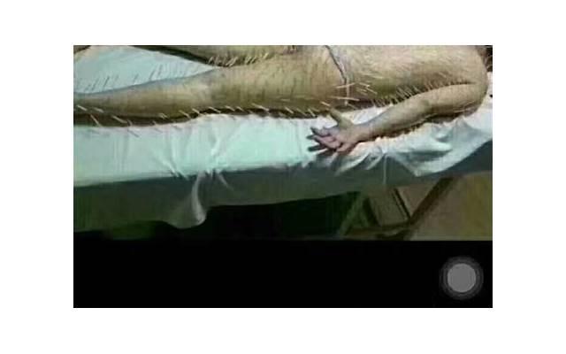 嘴巴溅到一滴百草枯会死吗（百草枯喝了能救活吗）