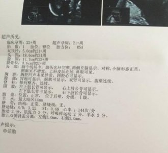 ​B超单上显示的3个“数据”，或许能告诉你想知道的答案！