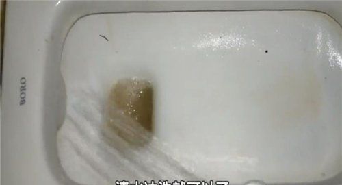 蹲坑发黄洗不掉怎么办,马桶底部黄污渍很重怎么去除图7