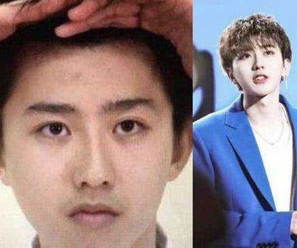 蔡徐坤素颜照 有网友恶搞他的丑图