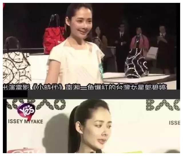 郭碧婷整容失败照流出？猪鼻子香肠嘴略吓人