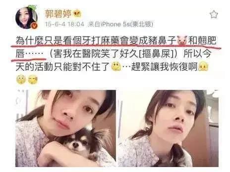 郭碧婷整容失败照流出？猪鼻子香肠嘴略吓人