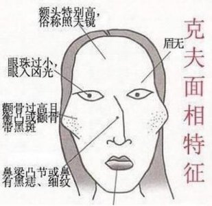 ​女性是否真的存在克夫现象？如何辨别以及克夫女性的性格特点是什么？