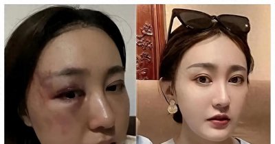 ​徐大宝：勇敢抵抗家暴，为女性权益发声