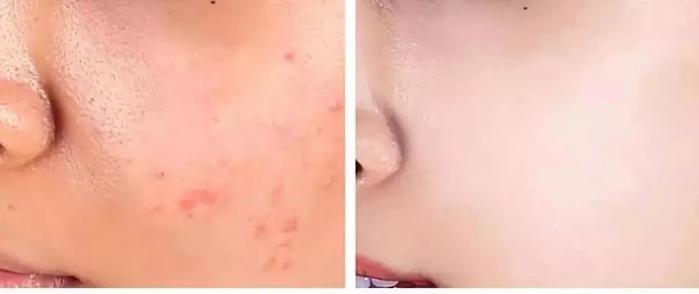 常敷面膜和不敷面膜的女生，皮肤差距到底有多大？