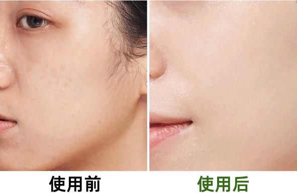 常敷面膜和不敷面膜的女生，皮肤差距到底有多大？