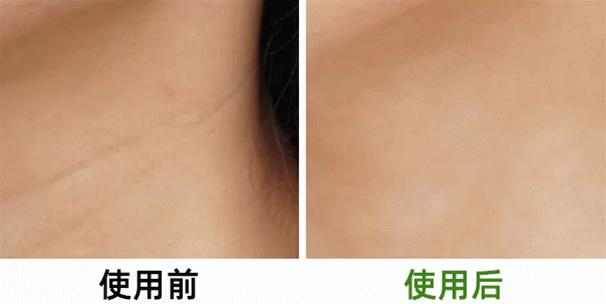 常敷面膜和不敷面膜的女生，皮肤差距到底有多大？