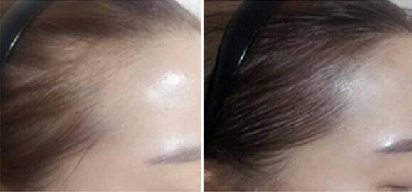 别总拿杨幂的发际线说事, 你先看看你自己的什么样