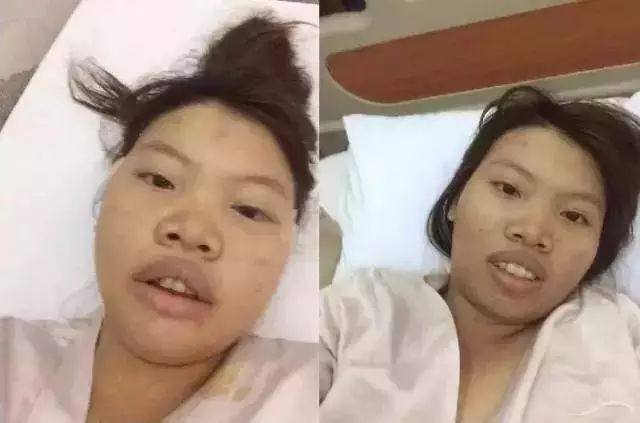 凤姐整容后最新照片，凤姐2025近照,本文共（7972字）