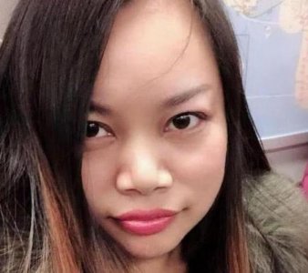 ​凤姐整容后的照片，弯弯姐整容前后