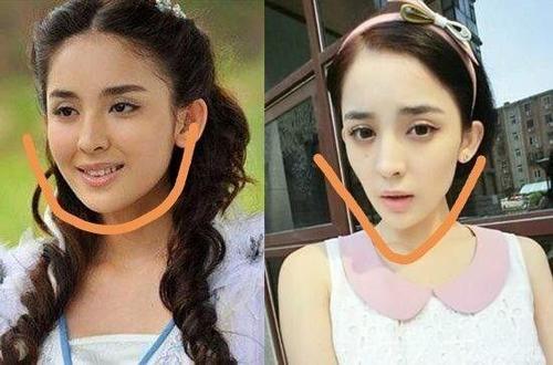 古力娜扎整容，张翰和郑爽,本文共（5146字）