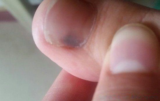 肝不好有什么症状有哪些表现 肝不好的人三黑两臭指什么