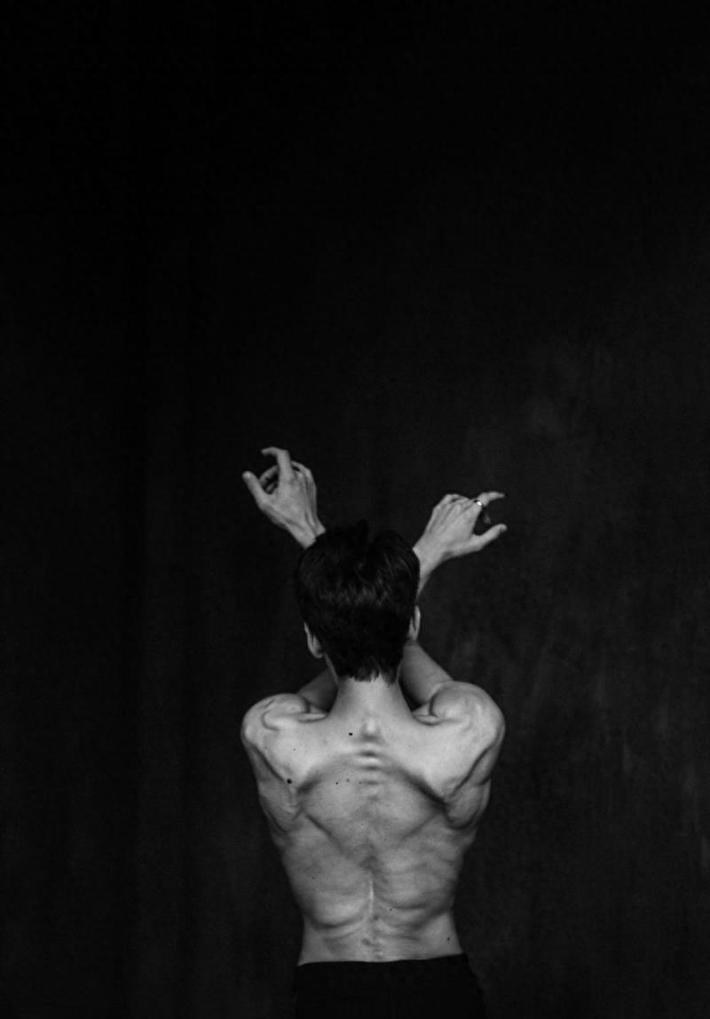 芭蕾舞者的美丽与艰辛 足部变形严重