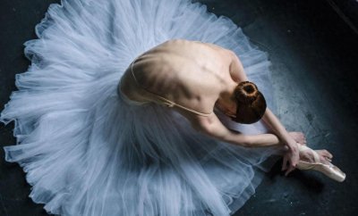 ​芭蕾舞者的美丽与艰辛 足部变形严重