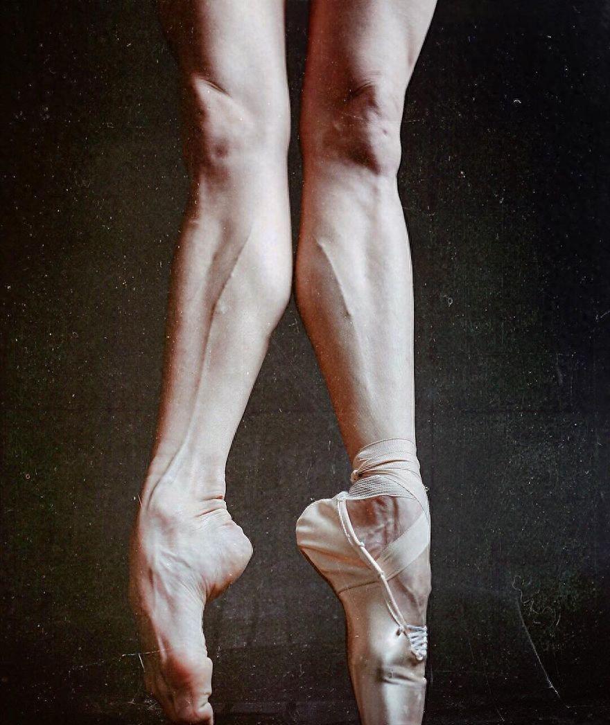 芭蕾舞者的美丽与艰辛 足部变形严重