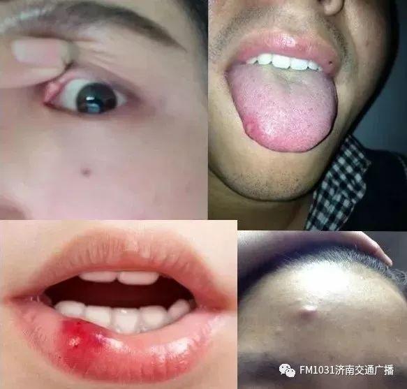 春季养肝护肝食谱大全（春季降火必备色泽金黄）(3)