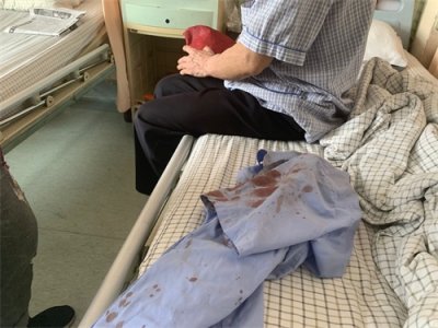 ​凌晨，济南59岁的哥与乘客起冲突鼻骨被打骨折！警方已介入